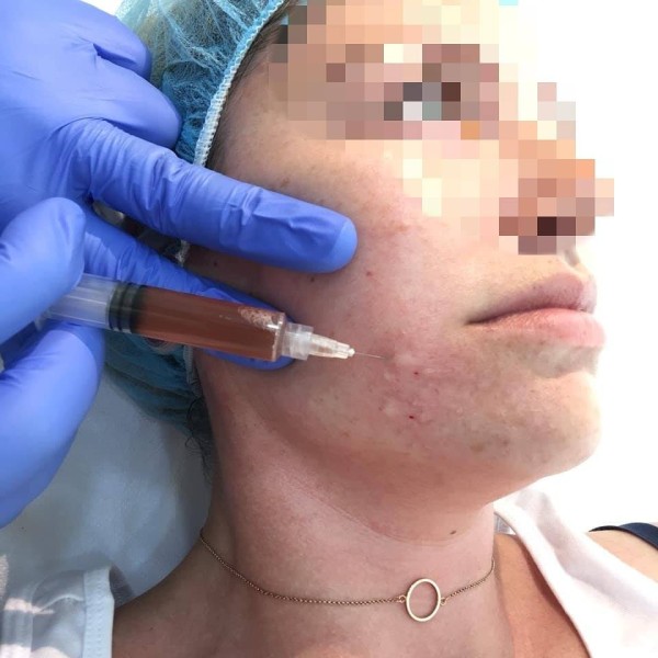 Dr Miloš Živković